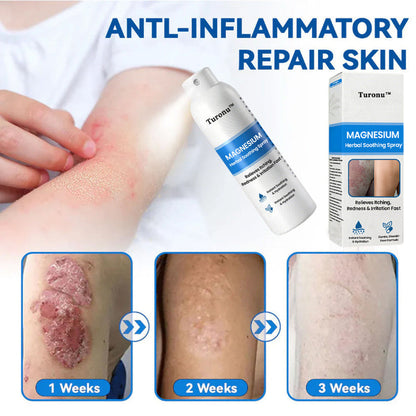 🔥【HOT】Magnesium Herbal Soothing Spray