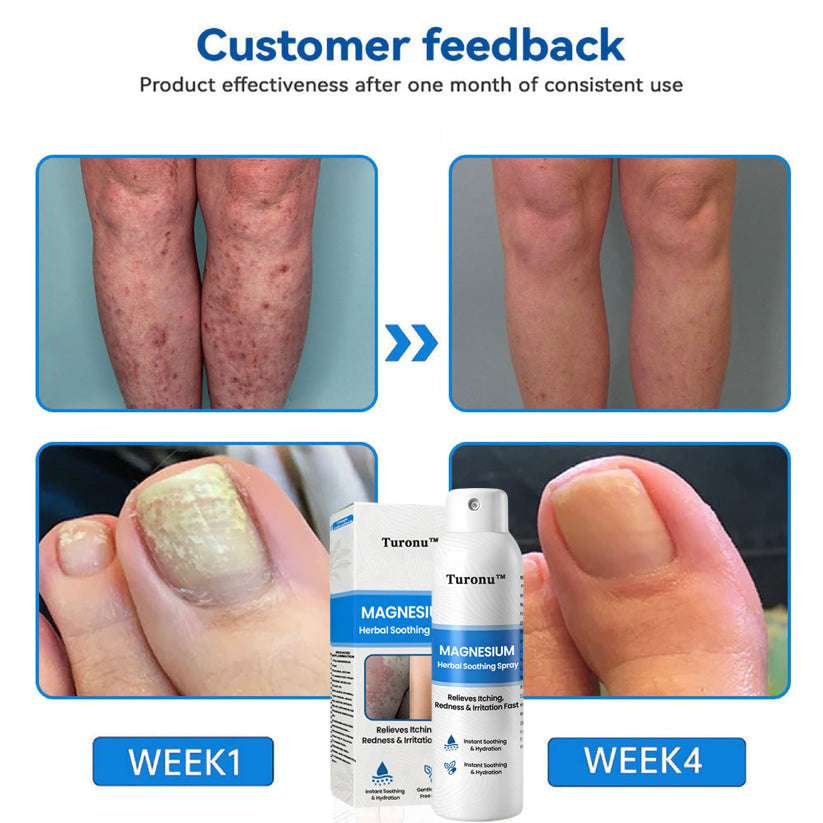 🔥【HOT】Magnesium Herbal Soothing Spray