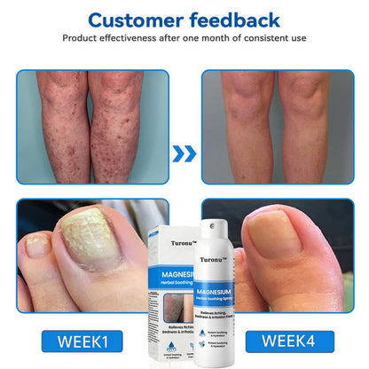 🔥【HOT】Magnesium Herbal Soothing Spray