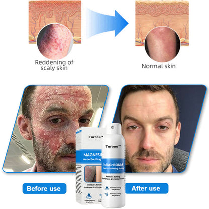 🔥【HOT】Magnesium Herbal Soothing Spray