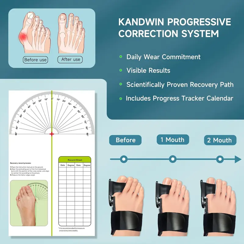 HOOMWELL™ Bunion Corrector for Women Men Big Toe:Instantly Relieve Bunion Pain & Restore Natural Alignment
