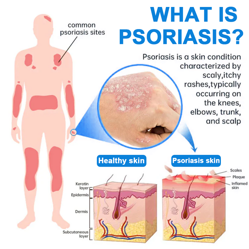 🔥【HOT】Magnesium Herbal Soothing Spray