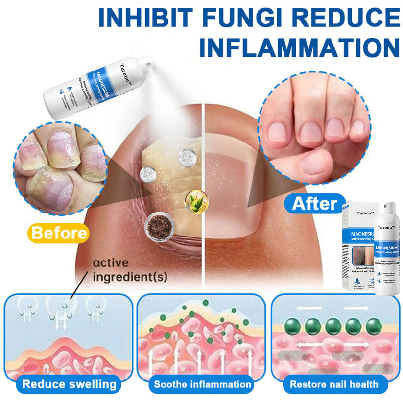 🔥【HOT】Magnesium Herbal Soothing Spray